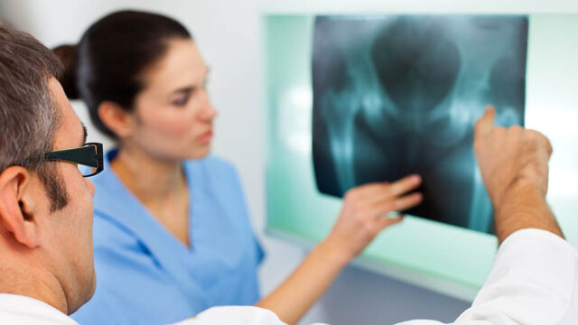 Doctor looking at X-ray image of a pelvis
