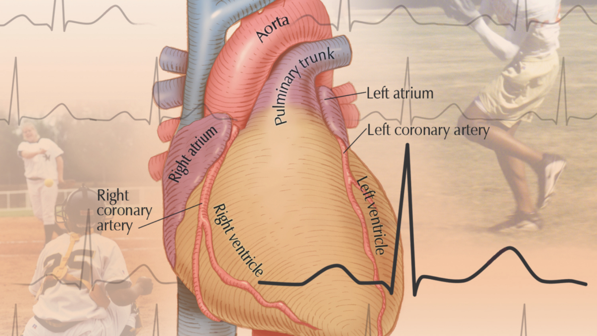 Atrial Fibrillation in Athletes